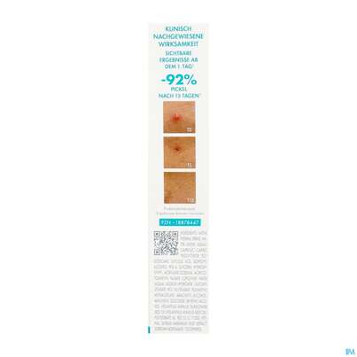 Sie sehen eine Packung Avene Cleanance Comedomed Intensiv Anti-pickel Akutpflege 40ml, Produktbild: 05 Avene Cleanance Comedomed Intensiv Anti-pickel Akutpflege 40ml, A-Nr.: 5899040 - 05