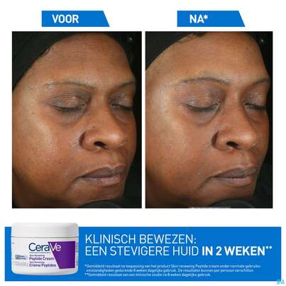 Cerave Skin Renewing Peptide Cr 48ml, A-Nr.: 5985696 - 11