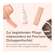 Nupure probariasis Tinktur, A-Nr.: 5778997 - 05